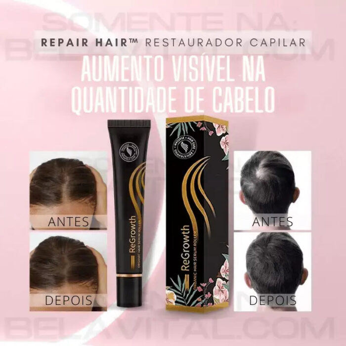 Kit Repair Hair: Tratamento Capilar Completo - Queda + Crescimento | 6 Unidades - vipzio