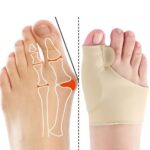 Corretor de joanete Almofada de Gel - vipzio