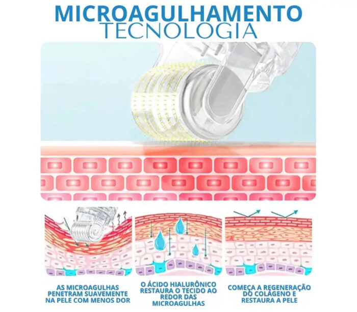 Microagulhamento com Serum Rejuvenescedor de Ácido Hialurônico - vipzio