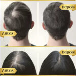 Diminui Queda 95% Aumenta Crescimento 20x | Repair Hair® | PAGUE 1 LEVE 2 - vipzio