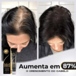 Diminui Queda 95% Aumenta Crescimento 20x | Repair Hair® | PAGUE 1 LEVE 2 - vipzio