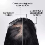 Diminui Queda 95% Aumenta Crescimento 20x | Repair Hair® | PAGUE 1 LEVE 2 - vipzio