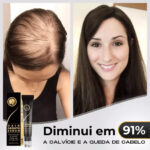 Diminui Queda 95% Aumenta Crescimento 20x | Repair Hair® | PAGUE 1 LEVE 2 - vipzio