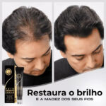 Diminui Queda 95% Aumenta Crescimento 20x | Repair Hair® | PAGUE 1 LEVE 2 - vipzio