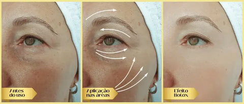 O creme para olheiras da bela vital com veneno de cobra age em rugas e linhas de expressão reduzindo
