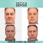 Kit Especial Dia dos Pais | Remove Olheiras, Diminui Queda, Aumenta Crescimento e Devolve Cor - vipzio