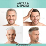 Kit Especial Dia dos Pais | Remove Olheiras, Diminui Queda, Aumenta Crescimento e Devolve Cor - vipzio