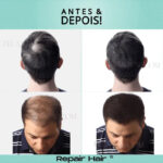 Kit Especial Dia dos Pais | Remove Olheiras, Diminui Queda, Aumenta Crescimento e Devolve Cor - vipzio