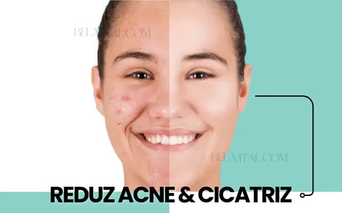 A Máscara de Arroz Reduz cicatrizes e remove espinhas e manchas de acnes na pele