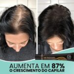 Sérum Repair Hair: Tratamento Revolucionário para Queda de Cabelo | Pague 1 e Leve 2 - vipzio