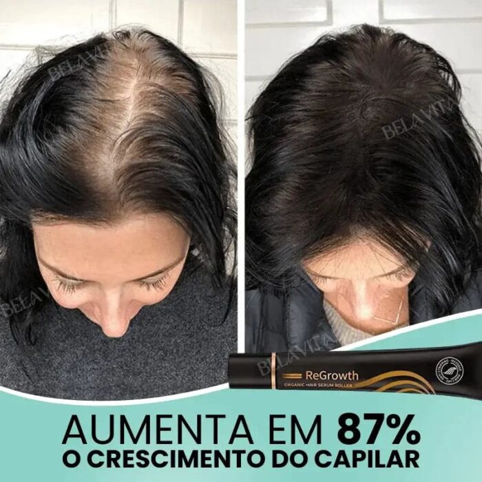 Sérum Repair Hair: Tratamento Revolucionário para Queda de Cabelo | Pague 1 e Leve 2 - vipzio