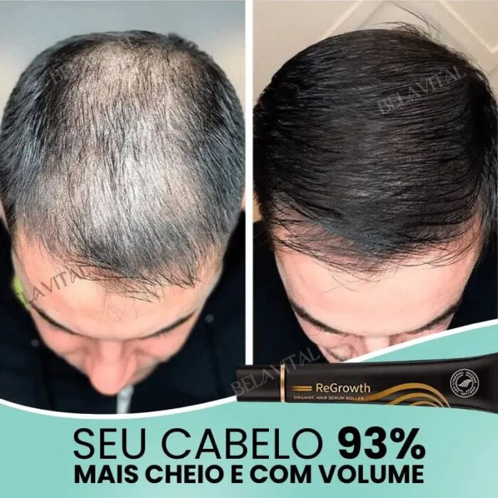 Sérum Repair Hair: Tratamento Revolucionário para Queda de Cabelo | Pague 1 e Leve 2 - vipzio