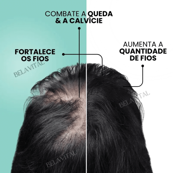 Sérum Repair Hair: Tratamento Revolucionário para Queda de Cabelo | Pague 1 e Leve 2 - vipzio