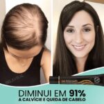 Sérum Repair Hair: Tratamento Revolucionário para Queda de Cabelo | Pague 1 e Leve 2 - vipzio