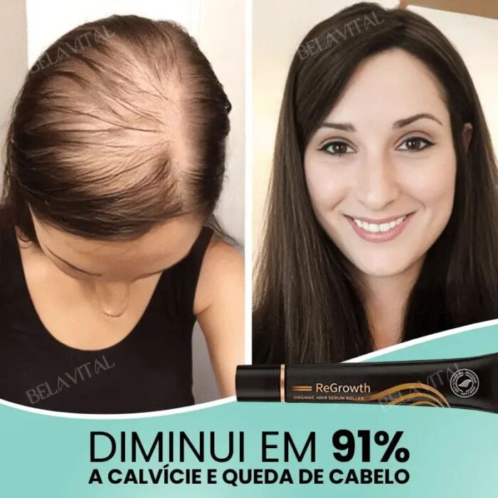 Sérum Repair Hair: Tratamento Revolucionário para Queda de Cabelo | Pague 1 e Leve 2 - vipzio
