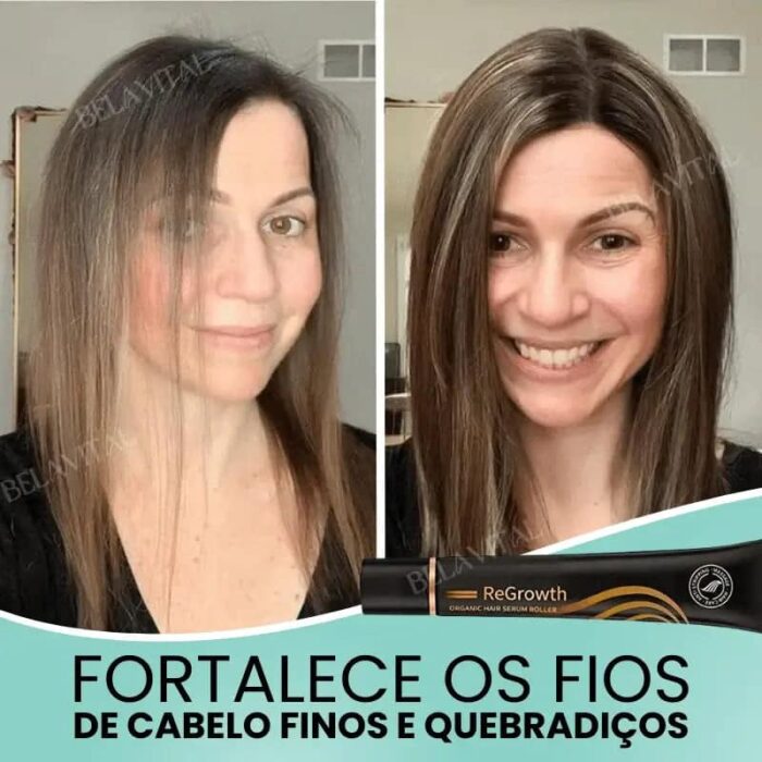 Sérum Repair Hair: Tratamento Revolucionário para Queda de Cabelo | Pague 1 e Leve 2 - vipzio