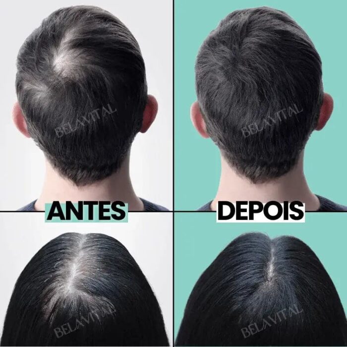 Sérum Repair Hair: Tratamento Revolucionário para Queda de Cabelo | Pague 1 e Leve 2 - vipzio