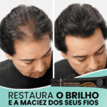 Sérum Repair Hair: Tratamento Revolucionário para Queda de Cabelo | Pague 1 e Leve 2 - vipzio