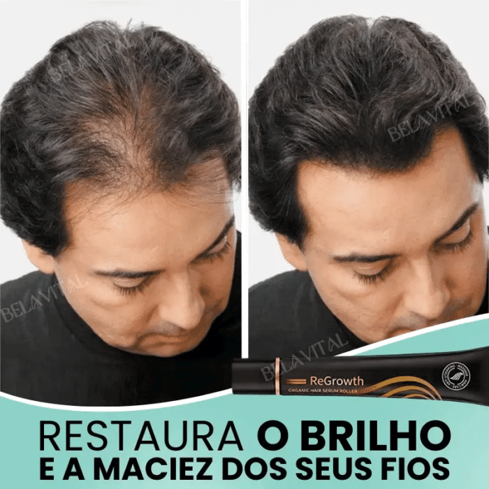 Sérum Repair Hair: Tratamento Revolucionário para Queda de Cabelo | Pague 1 e Leve 2 - vipzio