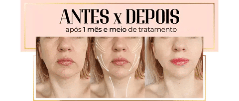 O Sérum Rejuvenescedor de Ouro 24k da bela vital funciona?