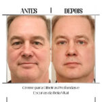Creme para Olheiras Profundas e Escuras - vipzio