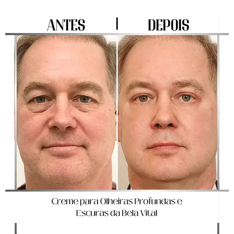 A ação contra olheira do creme da Bela Vital