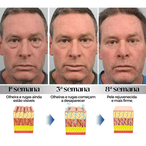 Eficácia do Creme anti olheira na prática