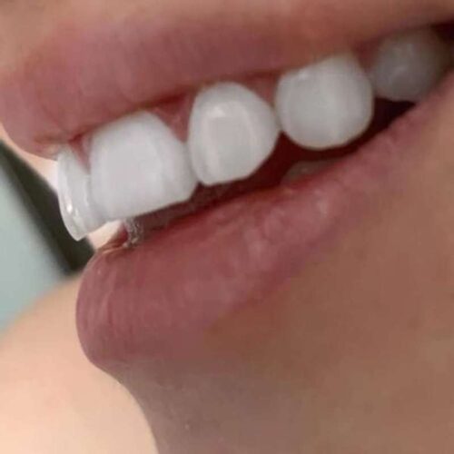 Clareador Dental Viya White photo review