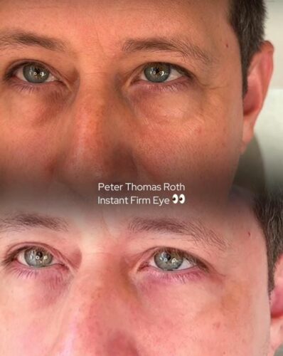 Creme firmador instantâneo para a área dos olhos - Purilify Lux photo review